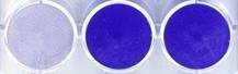 Toyoda Gosei Confirms High Effectiveness of Deep UV LED in Novel Coronavirus Inactivation