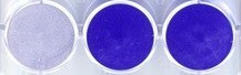 Toyoda Gosei Confirms High Effectiveness of Deep UV LED in Novel Coronavirus Inactivation